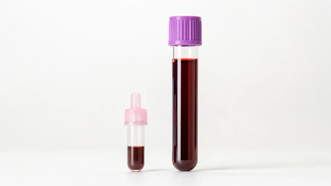 A finger-prick collection tube next to a standard venous blood draw tube, comparing at-home and clinic sample methods